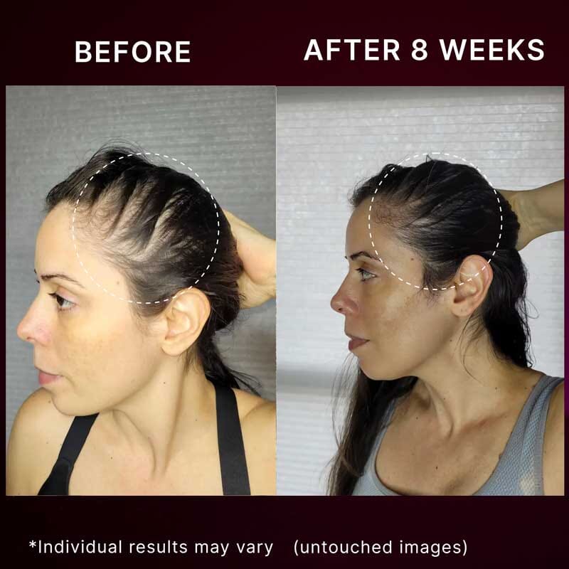 Nail n Mane - Ayurvedic Supplement for Healthy, Strong and Lustrous Hair and Nails - Image 4